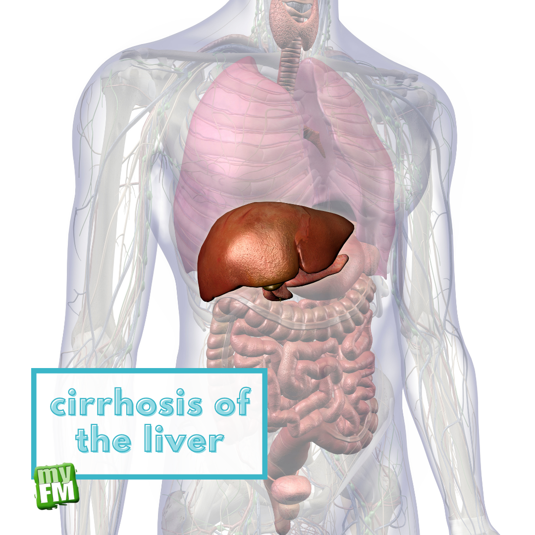 myFM: Cirrhosis of the liver